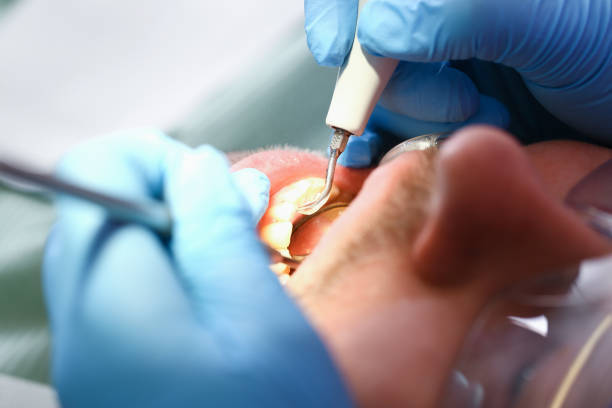 Best Weekend Emergency Dentist in Wolf Trap, VA
