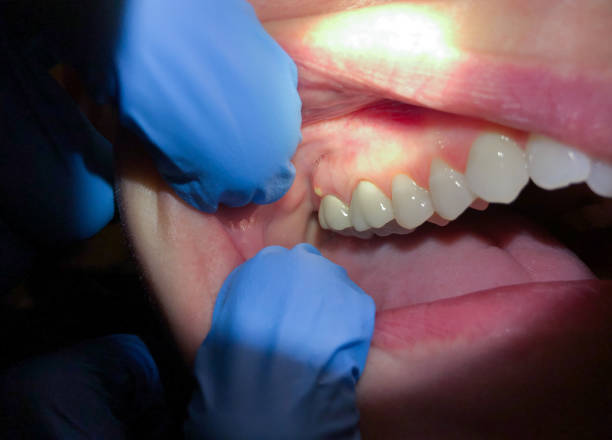 Best Emergency Dentist for Knocked-Out Tooth in Wolf Trap, VA